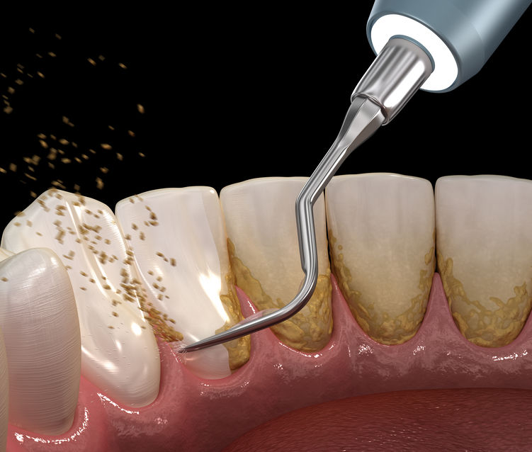 Periodontologia - Zielona Góra